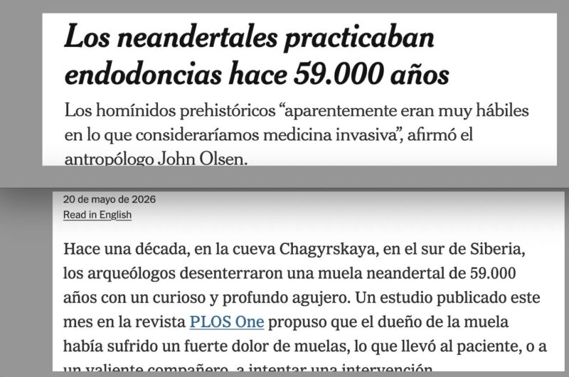 Endodoncias